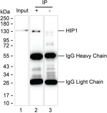 Mouse Monoclonal Antibody to HIP1