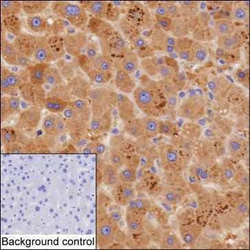 Mouse Monoclonal Antibody to SERPINC1