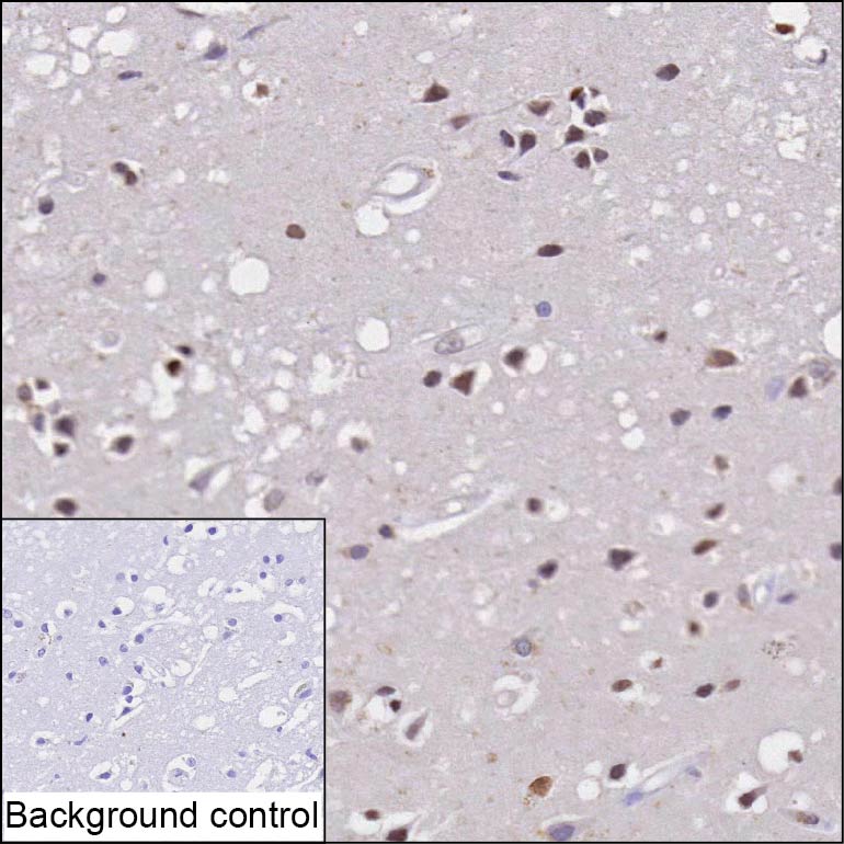 Mouse Monoclonal Antibody to GDNF