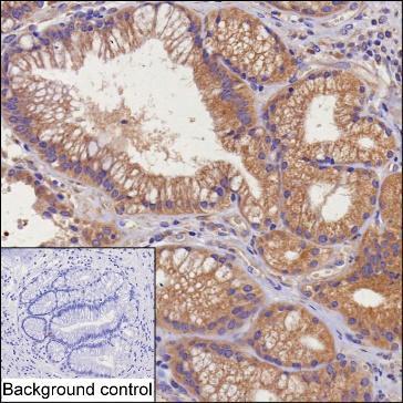 Mouse Monoclonal Antibody to STX17