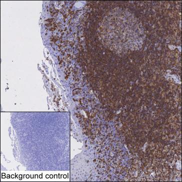 Mouse Monoclonal Antibody to ARHGAP45