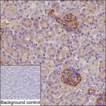 Mouse Monoclonal Antibody to OLR1
