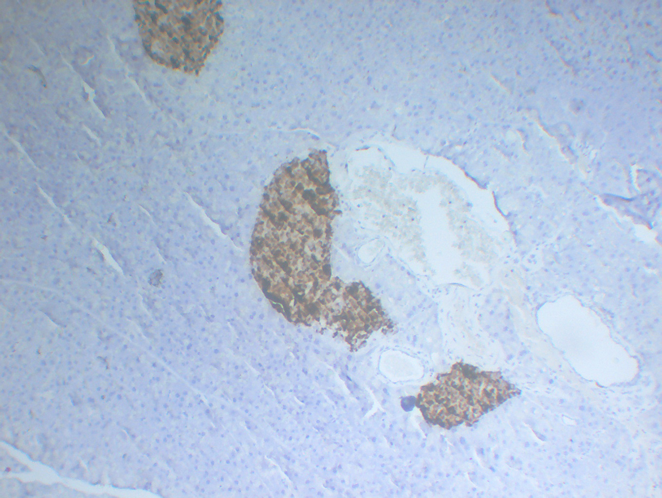Chromogranin A 