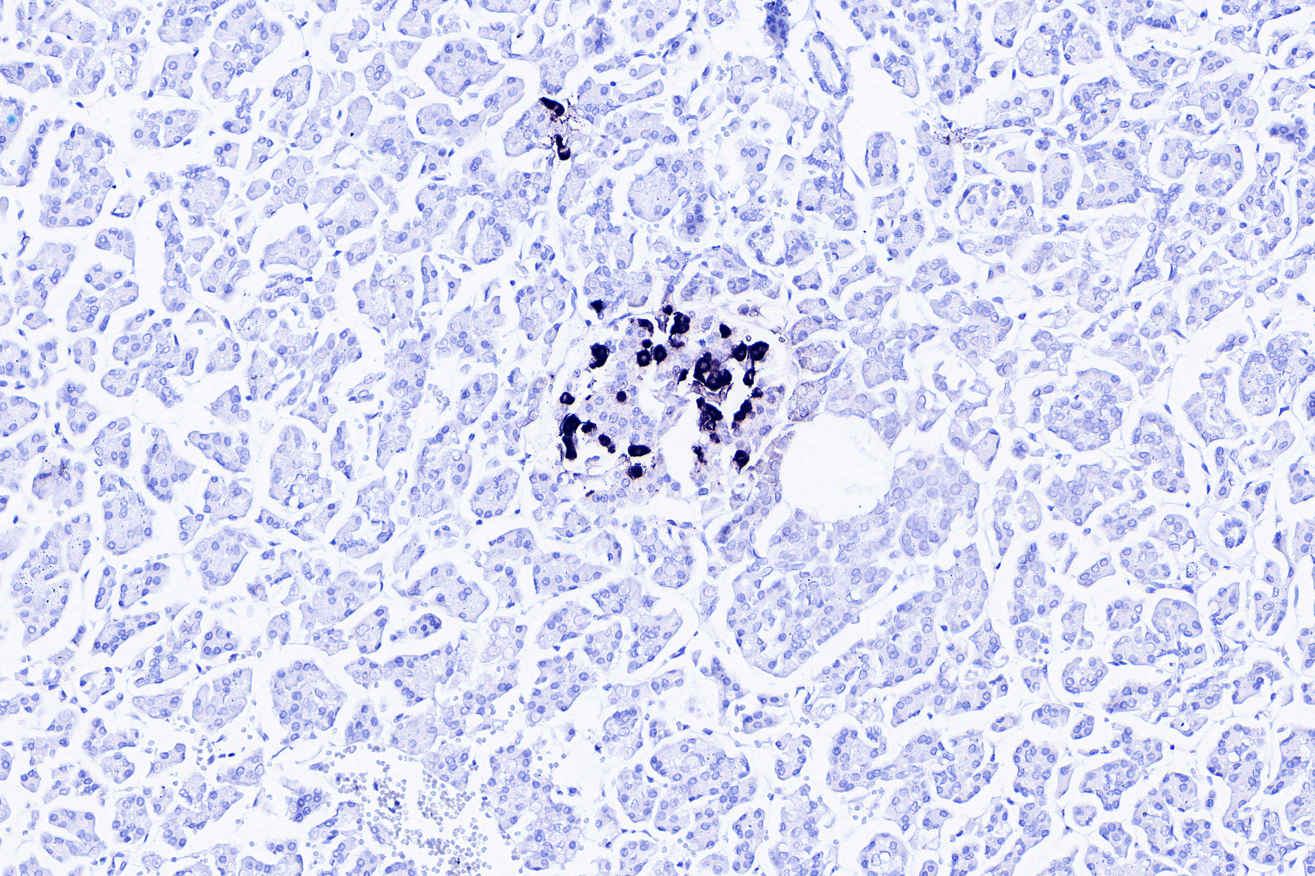 Somatostatin 