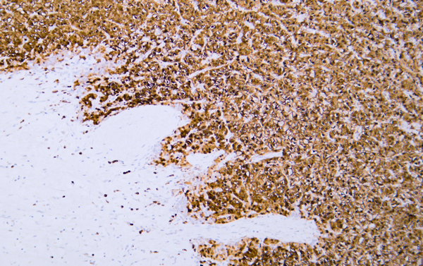 Arginase-1 