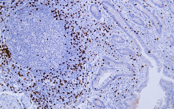 CD8 a 