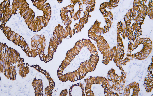 Cytokeratin 8&18 