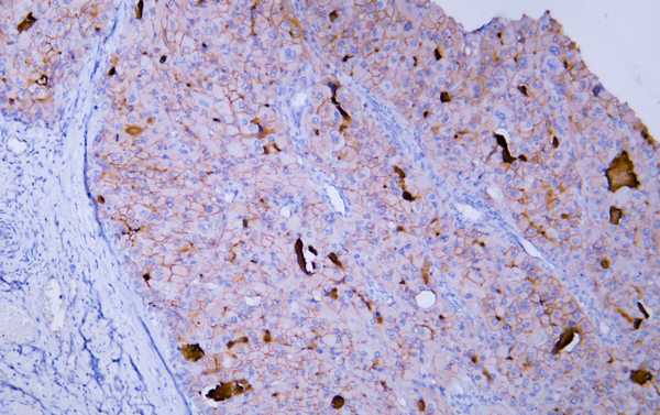 Glypican-3 