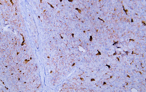 Glypican-3 