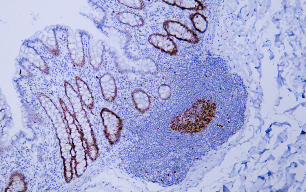 Proliferating Cell Nuclear Antigen 