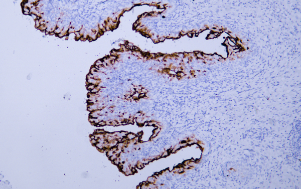 Uroplakin III 