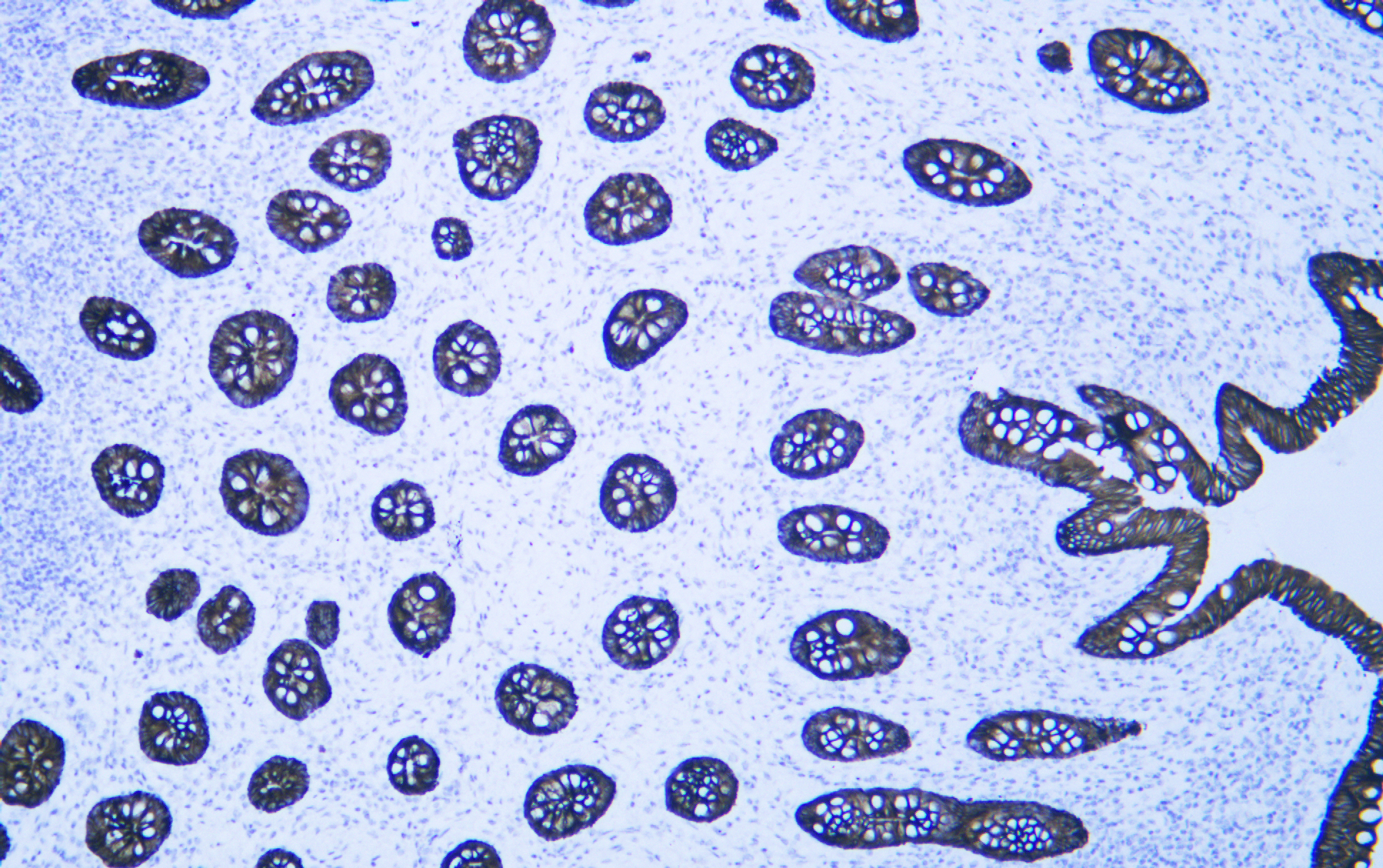 Cytokeratin 8 