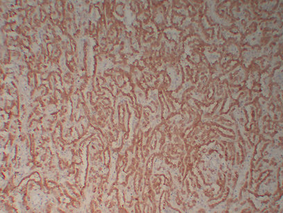 Calretinin 