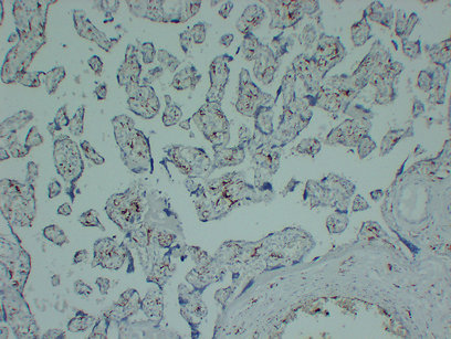 CD163 