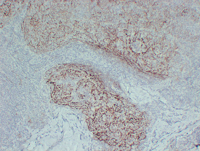 CD21 