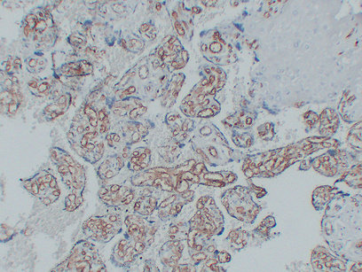 CD34 