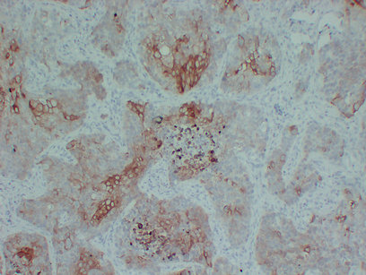 Cytokeratin 5 