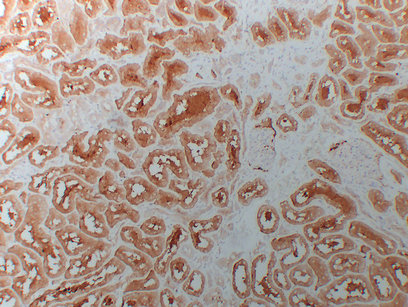 HDAC6 
