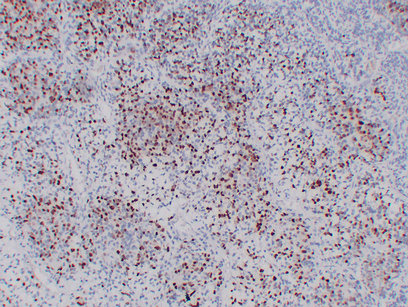Myogenin 
