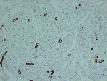 Actin, smooth muscle  