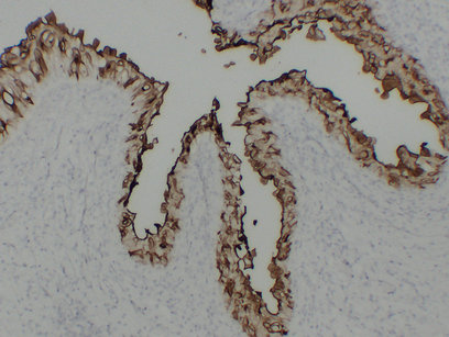 Uroplakin III 