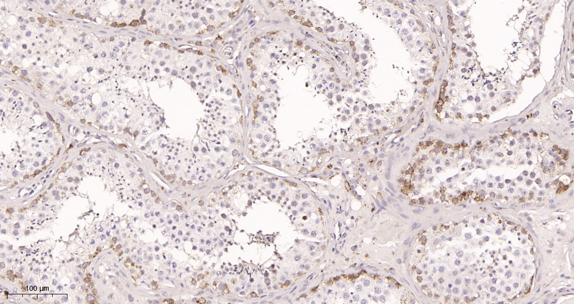 Rabbit Monoclonal Antibody to Hsp90