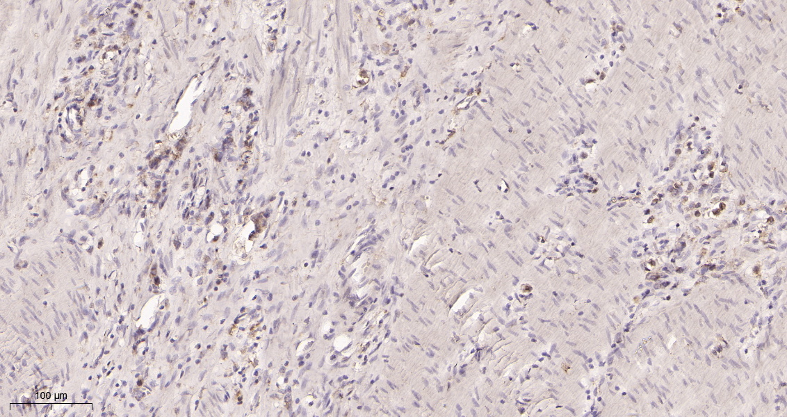 Rabbit Monoclonal Antibody to VEGF Receptor 1