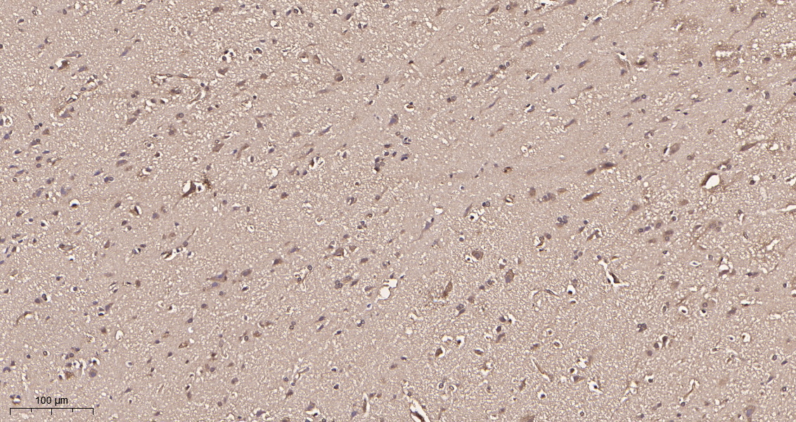 Rabbit Monoclonal Antibody to CDC37 (Phospho Ser13)