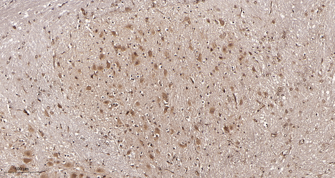 Rabbit Monoclonal Antibody to CDC37 (Phospho Ser13)