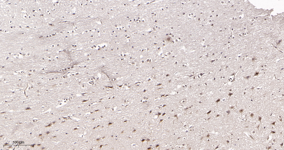 Rabbit Monoclonal Antibody to CDC37 (Phospho Ser13)