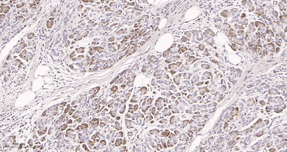 Rabbit Monoclonal Antibody to FOXO3A (Phospho Ser253)