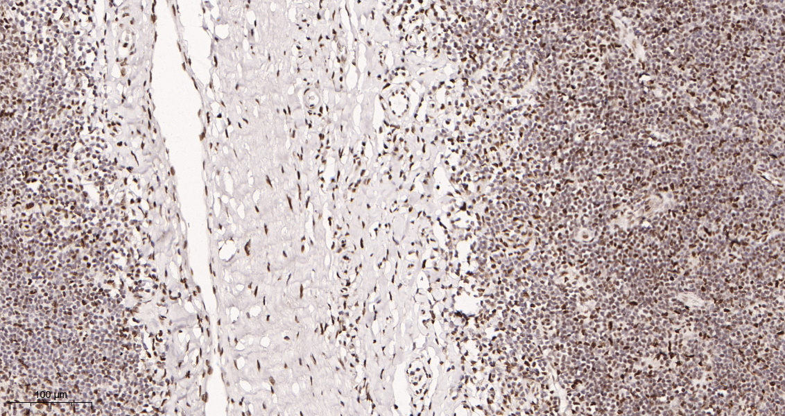 Rabbit Monoclonal Antibody to HDAC2