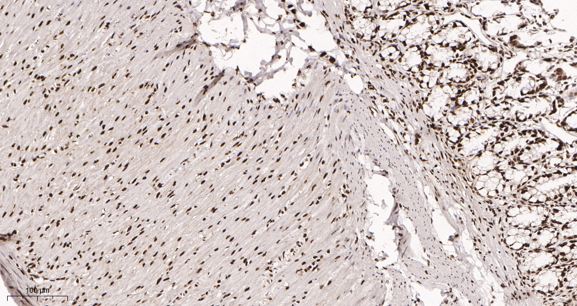Rabbit Monoclonal Antibody to HDAC2