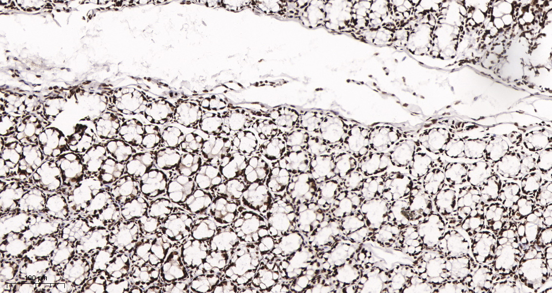 Rabbit Monoclonal Antibody to HDAC2