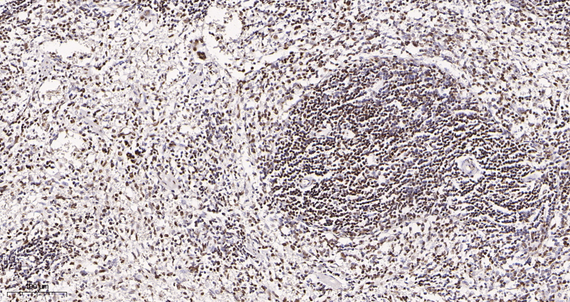 Rabbit Monoclonal Antibody to HDAC2