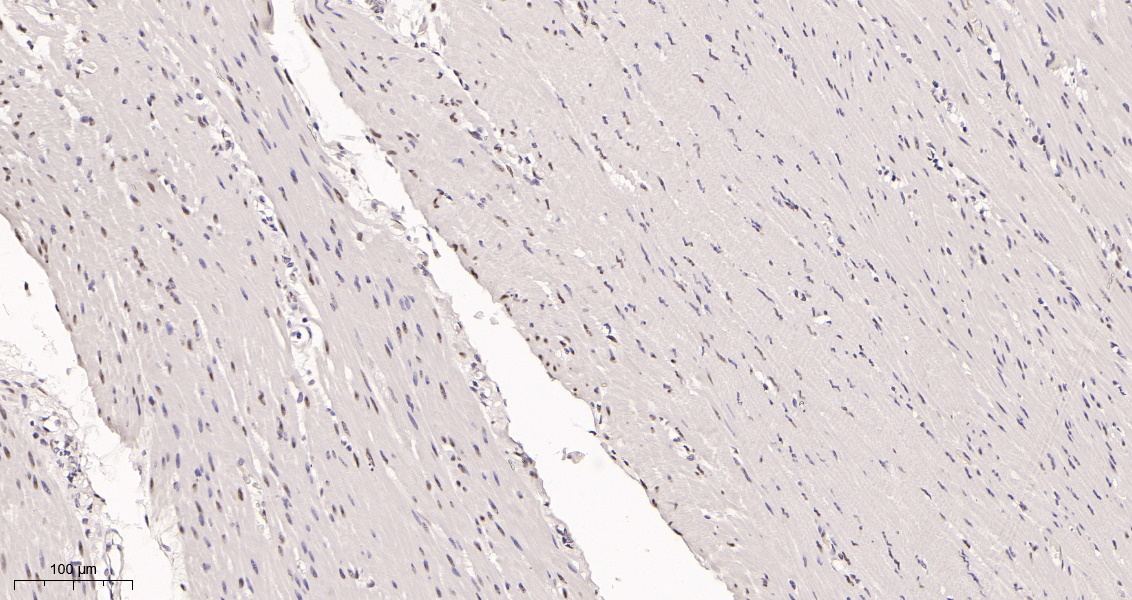 Rabbit Monoclonal Antibody to AREB6