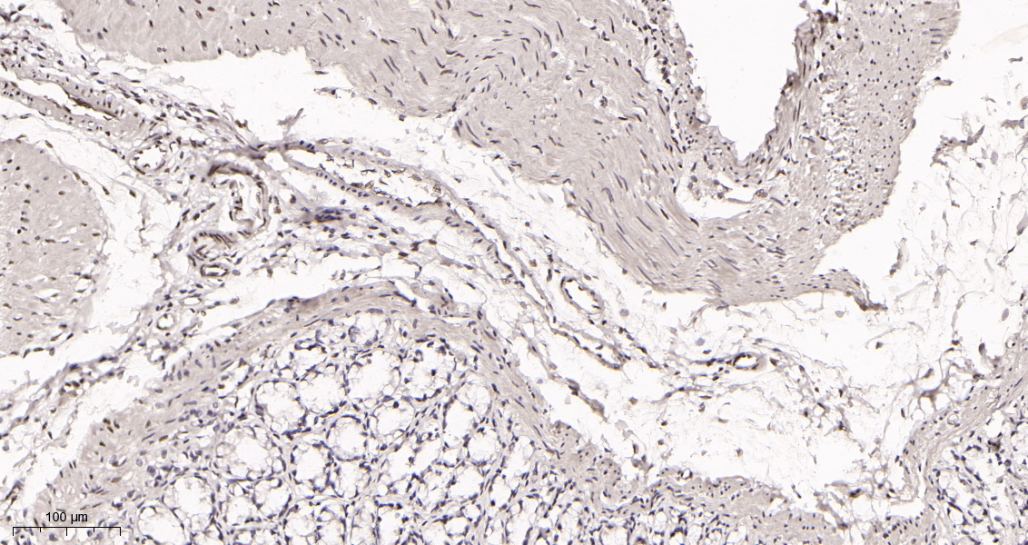 Rabbit Monoclonal Antibody to AREB6