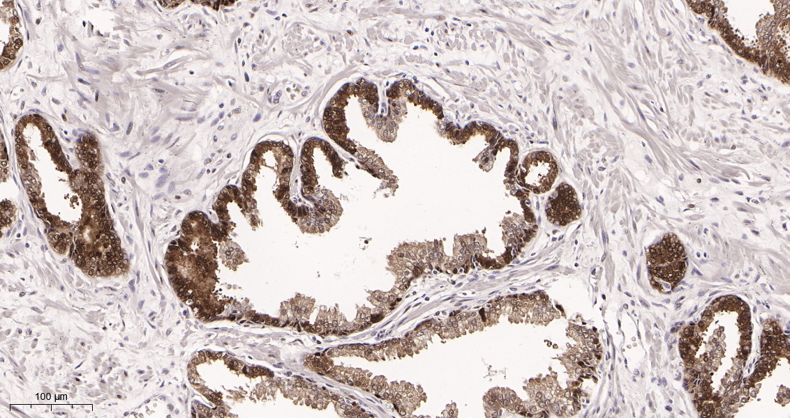Rabbit Monoclonal Antibody to Hsp70