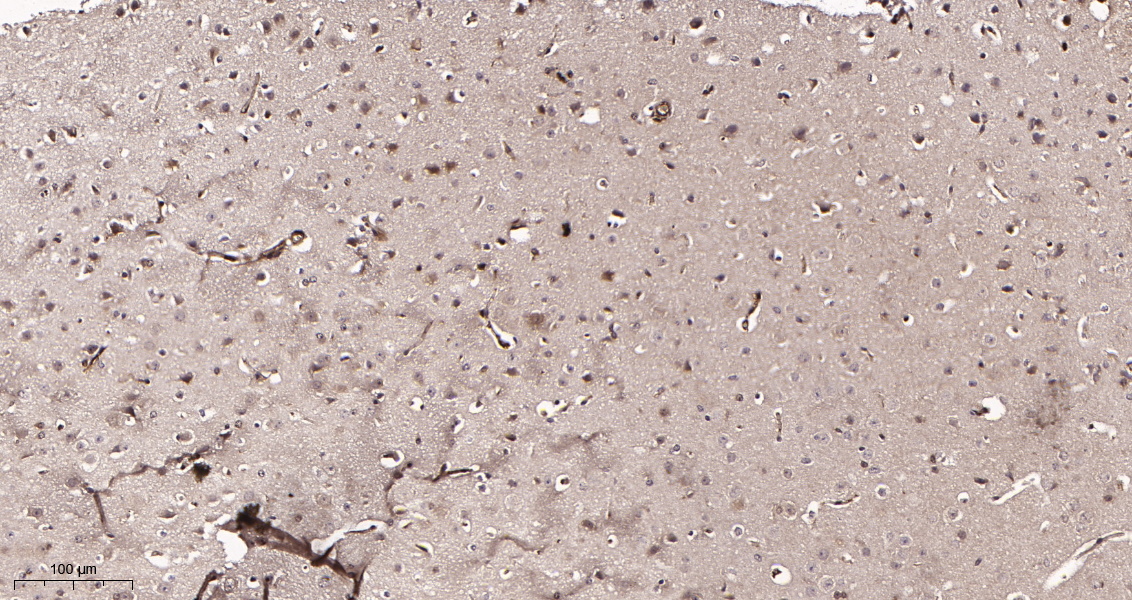 Rabbit Monoclonal Antibody to Hsp70