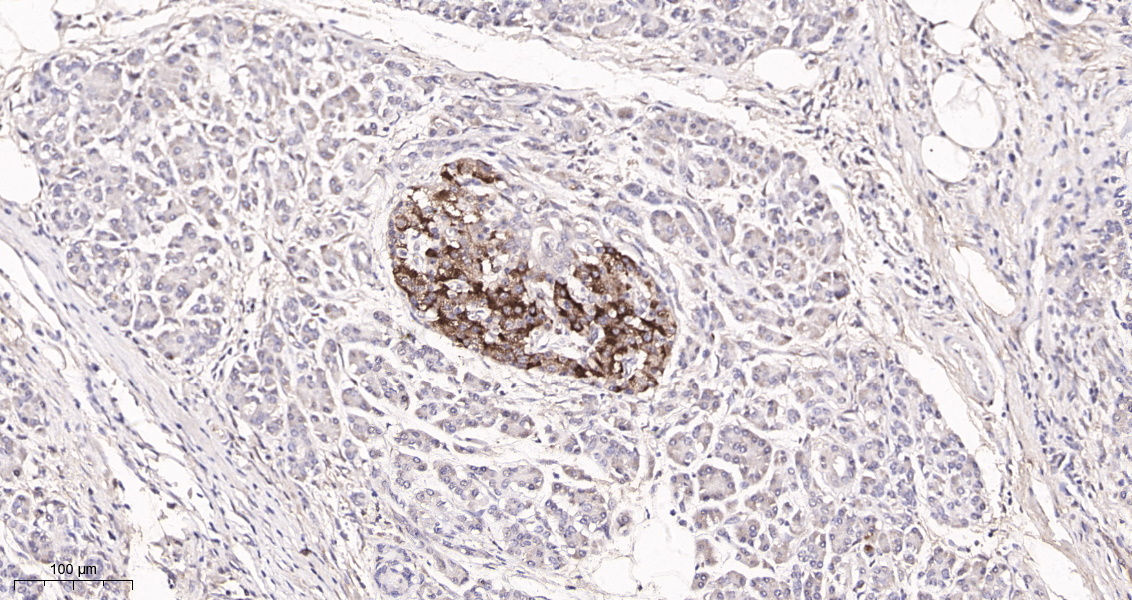 Rabbit Monoclonal Antibody to PTEN