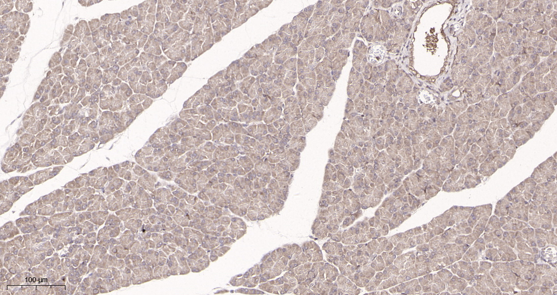 Rabbit Monoclonal Antibody to PTEN