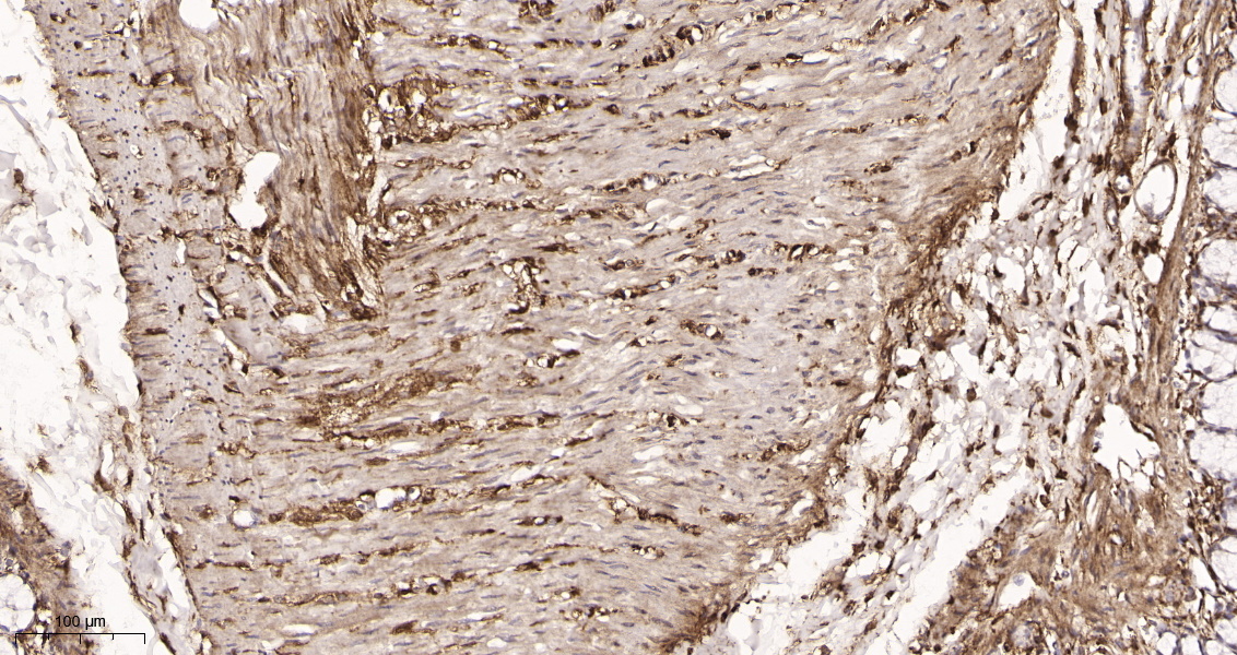 Rabbit Monoclonal Antibody to LRP1