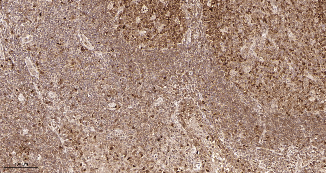 Rabbit Monoclonal Antibody to CDK2