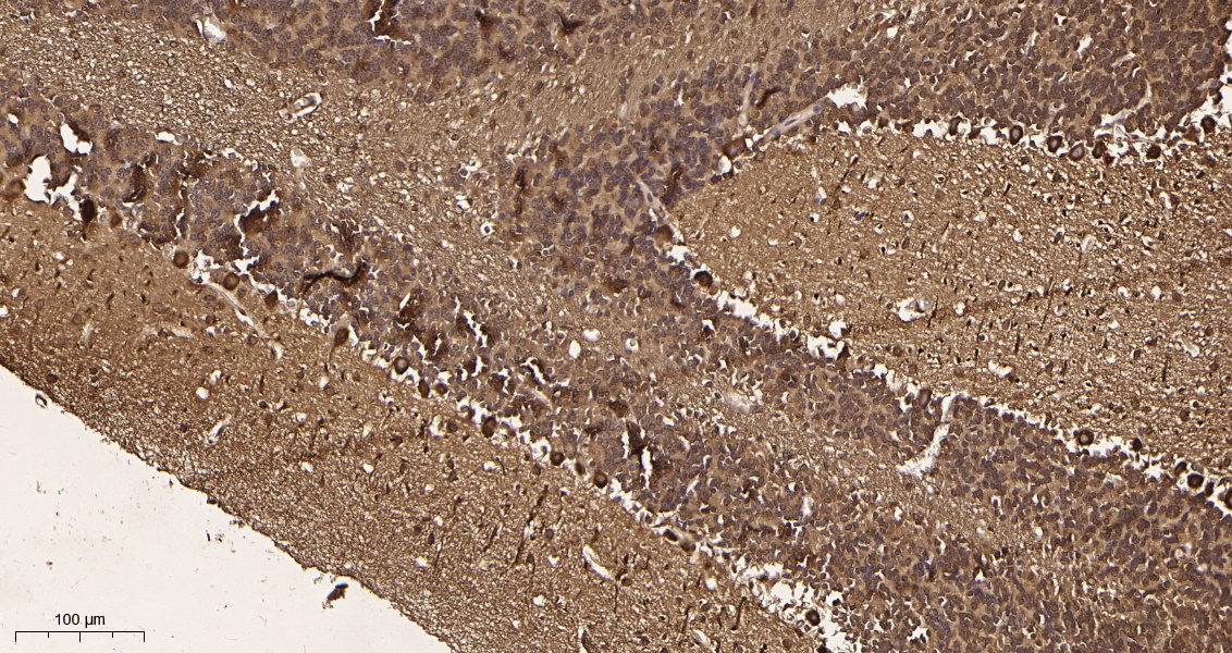 Rabbit Monoclonal Antibody to LC3B