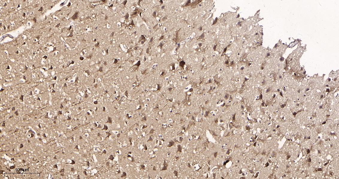 Rabbit Monoclonal Antibody to LC3B