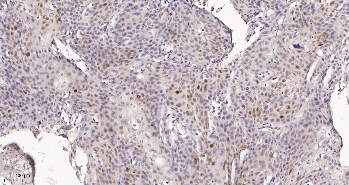 Rabbit Monoclonal Antibody to p21