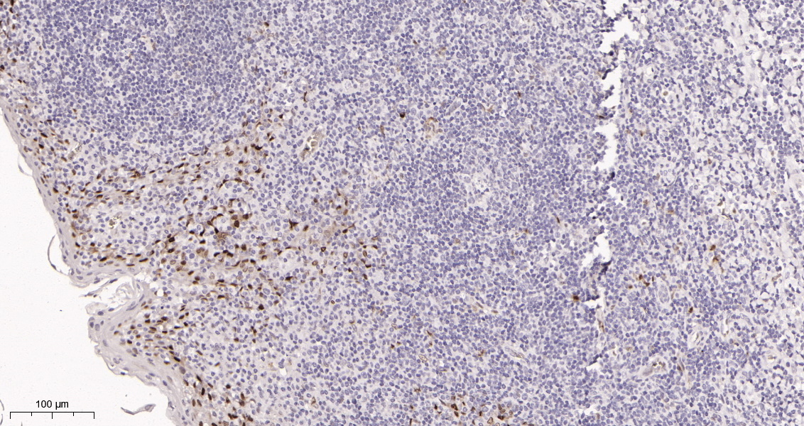 Rabbit Monoclonal Antibody to Cyclin D1