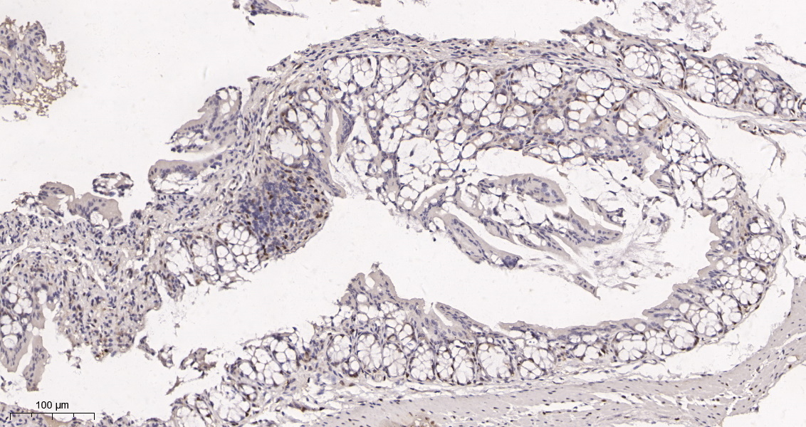 Rabbit Monoclonal Antibody to Cyclin D1