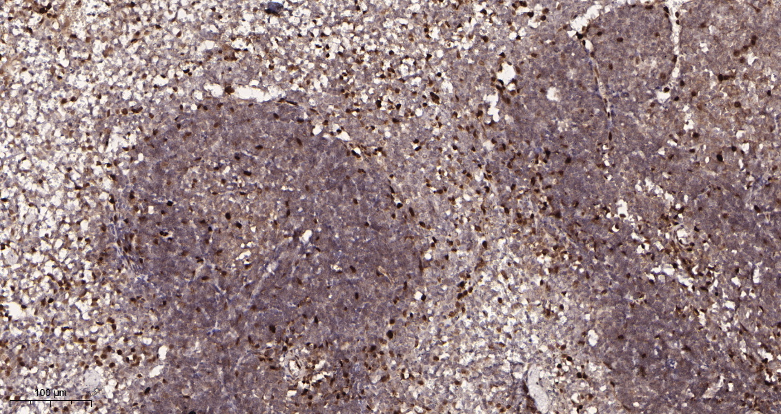 Rabbit Monoclonal Antibody to Cyclin D1