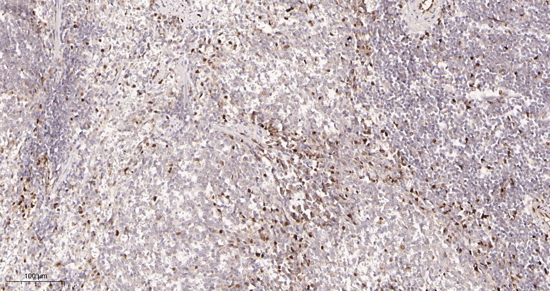 Rabbit Monoclonal Antibody to Cyclin D1